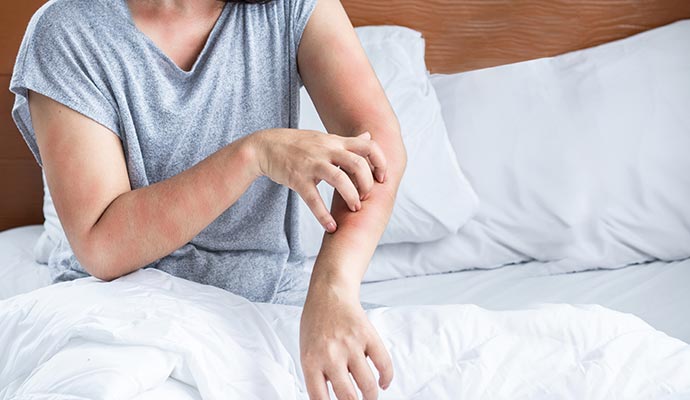 Woman having allergy effects
